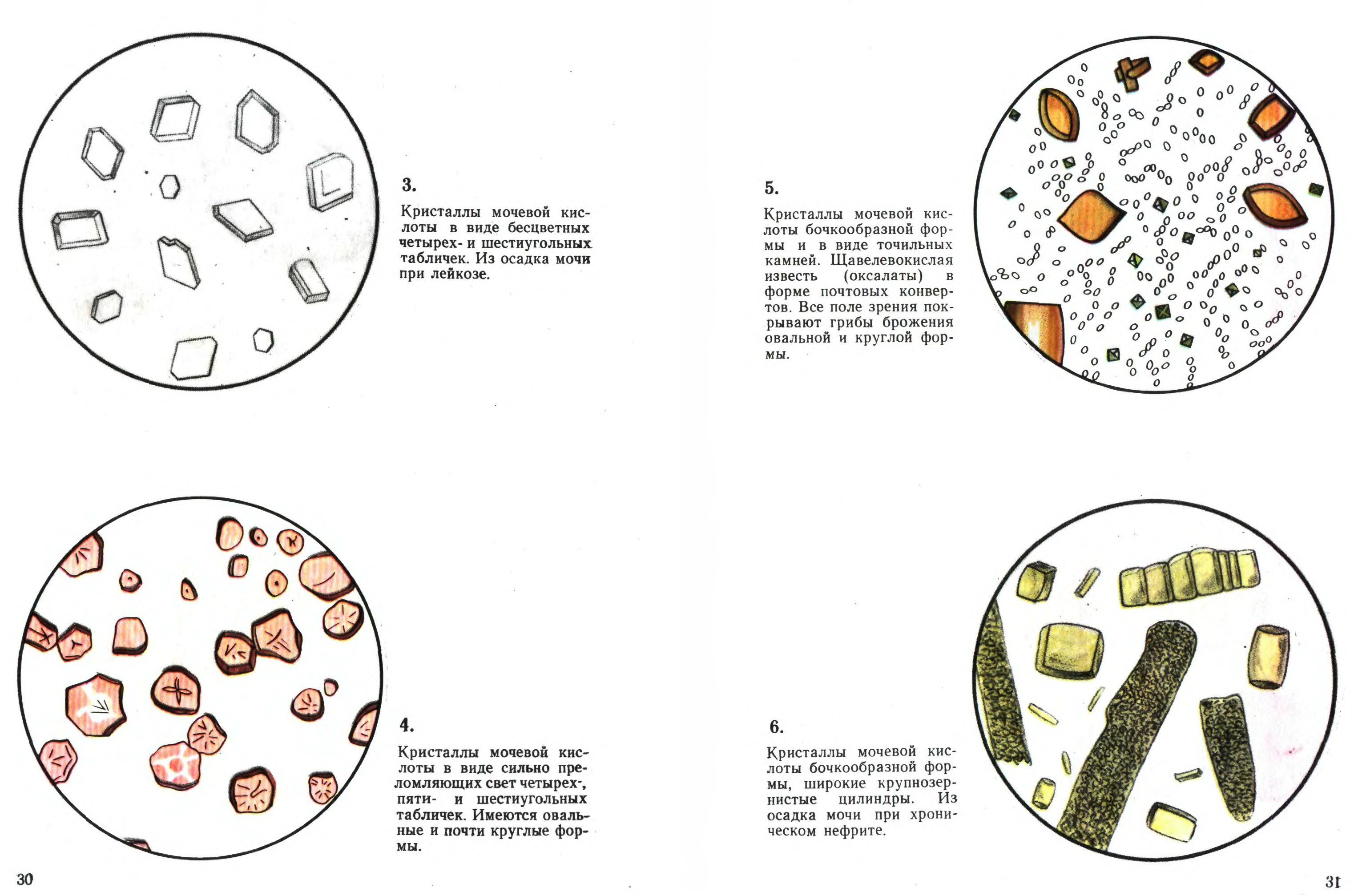 Состав солей в моче. Микроскопия неорганизованного осадка мочи. Соли в моче микроскопия атлас. Микроскопия осадка мочи неорганизованный осадок. Микроскопия осадка мочи атлас.