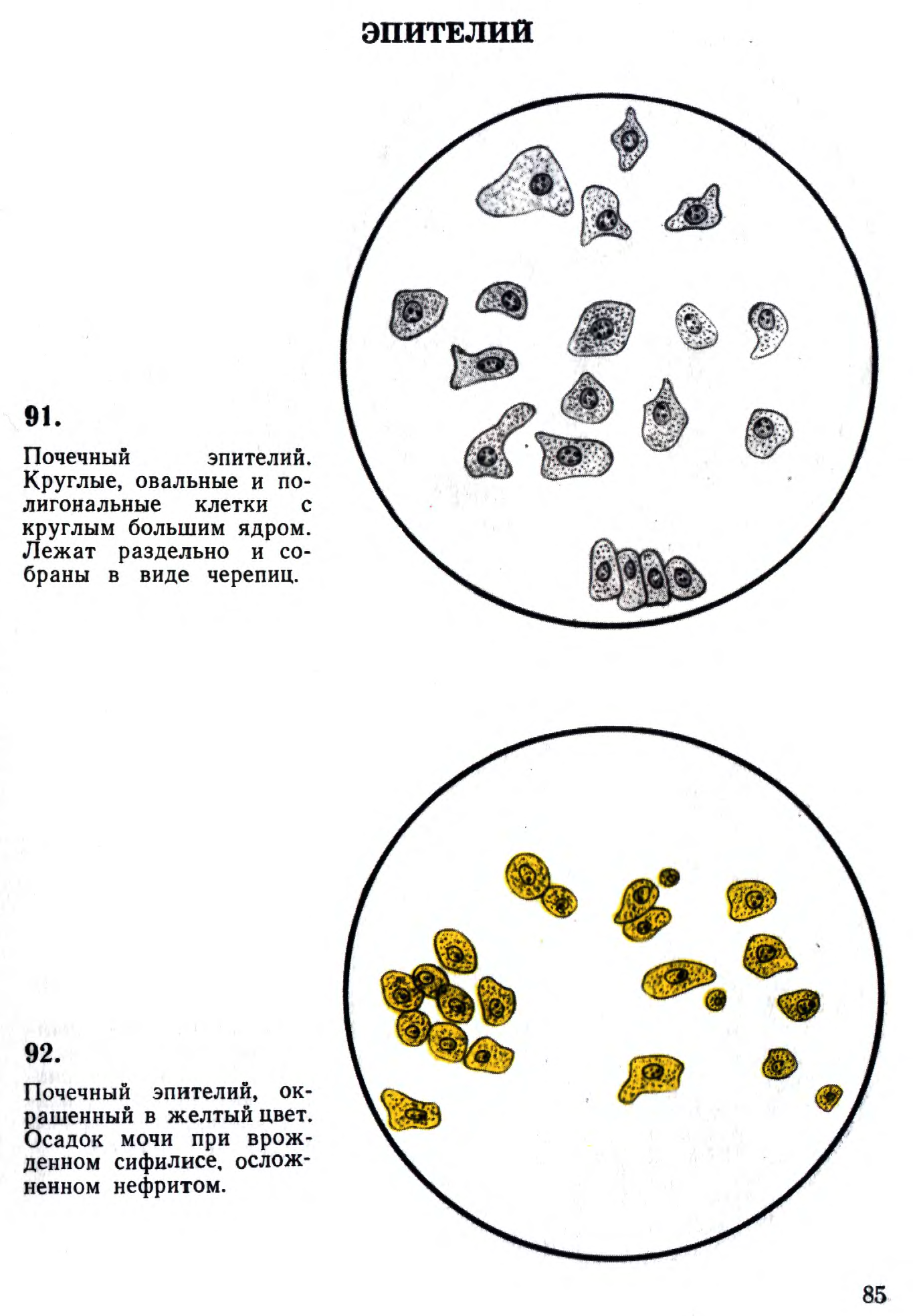 Микроскопия Осадка Мочи Фото С Описанием Образец – Telegraph