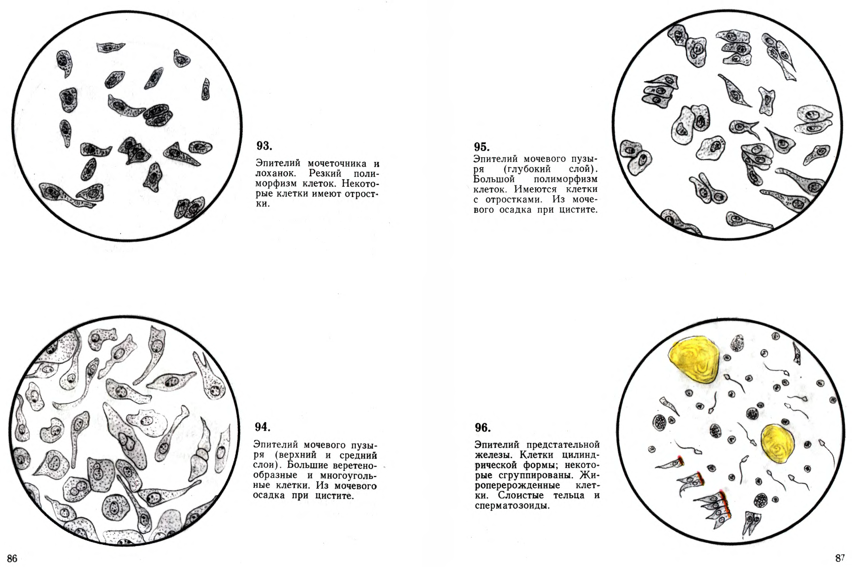 Лейкоциты в моче у собаки. Микроскопии осадков мочи Краевский в.я. Микроскопия осадка мочи атлас. Почечный эпителий в моче микроскопия. Атлас микроскопии осадков мочи эпителий.